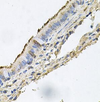 DSG1 Antibody