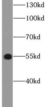 CMKLR1 Rabbit Polyclonal Antibody