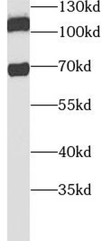 CHAF1B Antibody