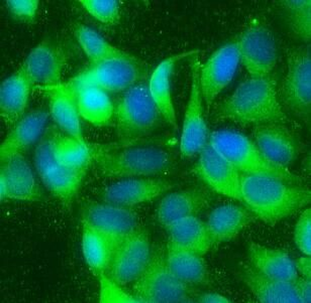 CHAF1B Antibody