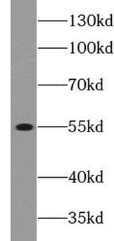 C3AR1 Rabbit Polyclonal Antibody