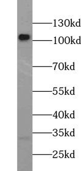 TLR2 Rabbit Polyclonal Antibody