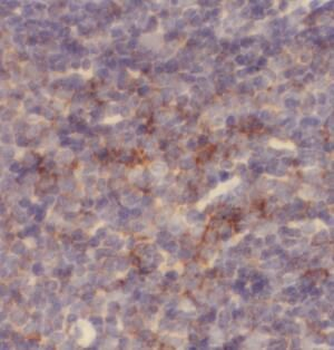 TLR2 Rabbit Polyclonal Antibody
