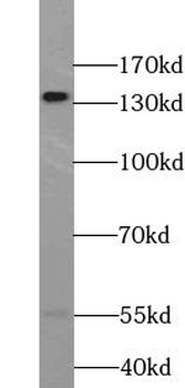 EPHA2 Mouse Monoclonal Antibody