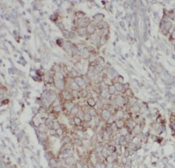 MMP16 Antibody