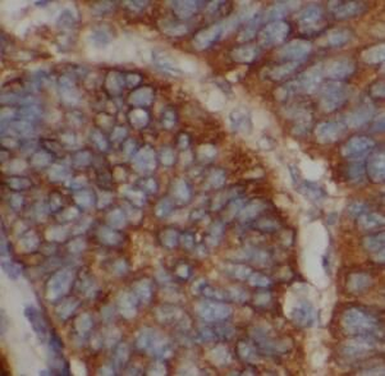 HSPA5 Antibody