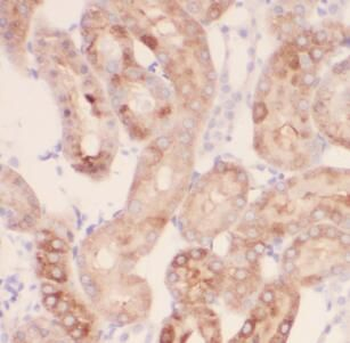 MAS1 Antibody