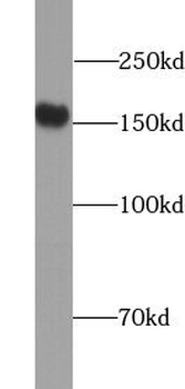 YTHDC2 Antibody