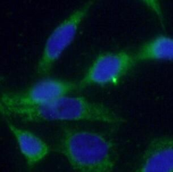 YTHDC2 Antibody