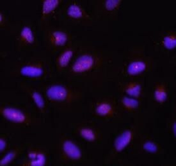Pan-AKT Antibody