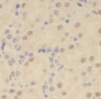 Pan-AKT Antibody