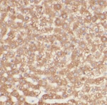 PIEZO2 Antibody