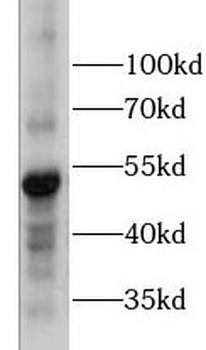 Phospho Camk2a  (T286) Rabbit Polyclonal Antibody