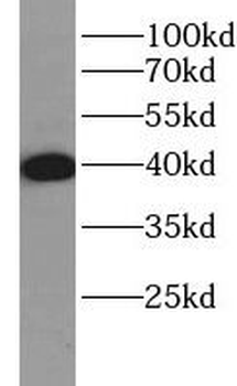 CD7 Rabbit Polyclonal Antibody
