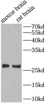 FGF23 Rabbit Polyclonal Antibody