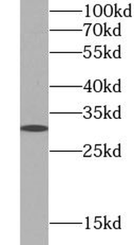 KLRK1 Rabbit Polyclonal Antibody