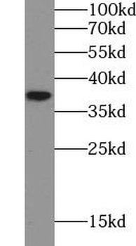 AKR1C2 Antibody