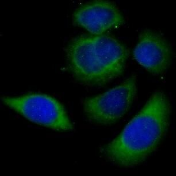 AKR1C2 Antibody