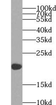 TSPO Rabbit Polyclonal Antibody