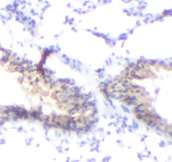 CHAT Antibody