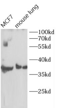 CCND1 Rabbit Polyclonal Antibody
