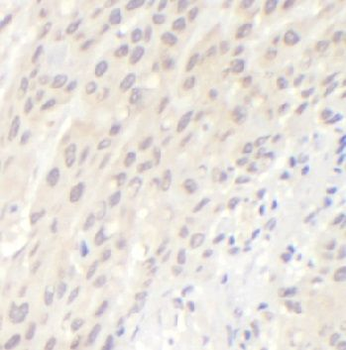 CCND1 Rabbit Polyclonal Antibody