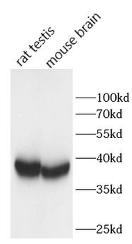BIRC8 Antibody