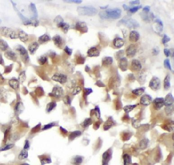 BIRC8 Antibody