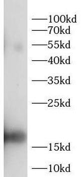 LEP Rabbit Polyclonal Antibody