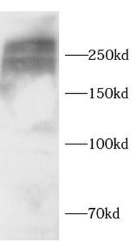 FN1 Rabbit Polyclonal Antibody