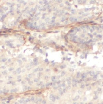 FN1 Rabbit Polyclonal Antibody