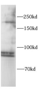 DICER1 Rabbit Polyclonal Antibody