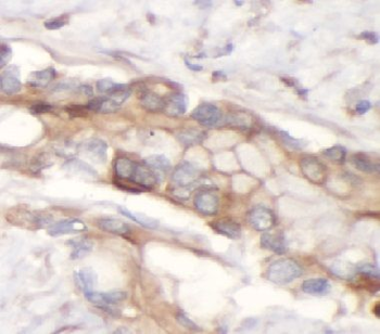 SLC1A2 Antibody