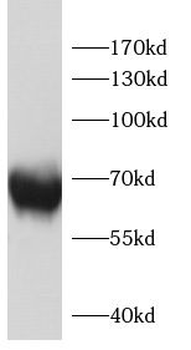 FSHR Rabbit Polyclonal Antibody