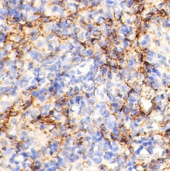 CD81 Rabbit Polyclonal Antibody
