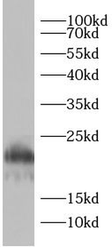 AGR2 Rabbit Polyclonal Antibody