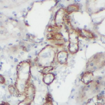 AGR2 Rabbit Polyclonal Antibody