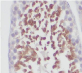 γ-H2AX Antibody