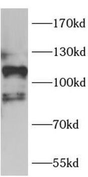 Aβ42 Rabbit Polyclonal Antibody