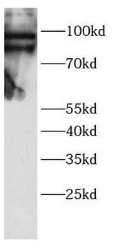 TAB3 Antibody