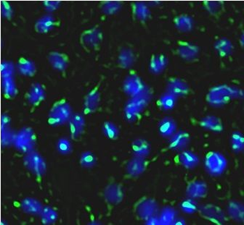 TAB3 Antibody