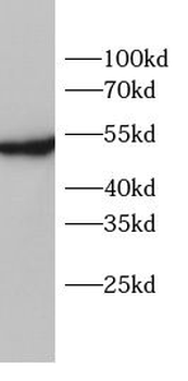 EPOR Rabbit Polyclonal Antibody