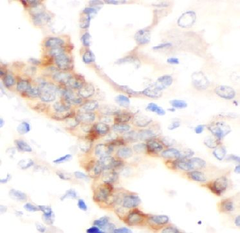 EPOR Rabbit Polyclonal Antibody