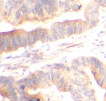 ADA Antibody