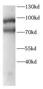 GLB1 Rabbit Polyclonal Antibody
