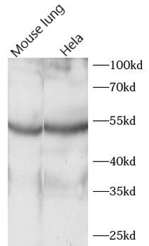 ACOXL Rabbit Polyclonal Antibody