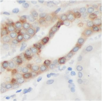 ACOXL Antibody