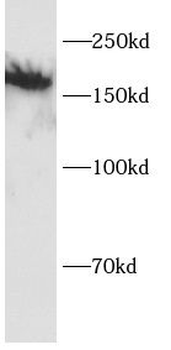 ITGAL Rabbit Polyclonal Antibody
