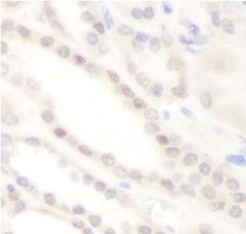 CAB39L Antibody