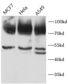 CD44 Rabbit Polyclonal Antibody